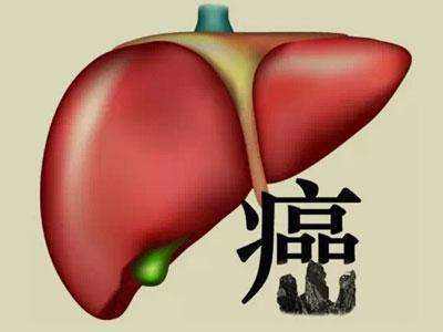 肝癌不痛不痒 4个“地方”可能会看出来药厂实拍