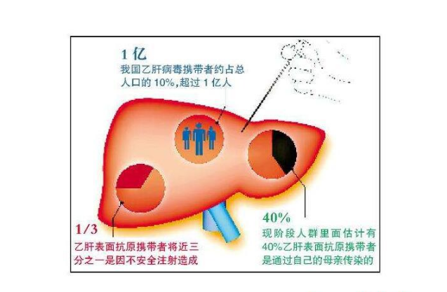 乙肝,病毒,携带者,需要,检查,五项,来,确定,