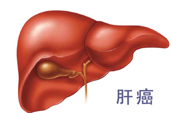 <b>肝癌能活多长时间？需要从肿瘤情况看肝癌的阶段</b>药厂实拍