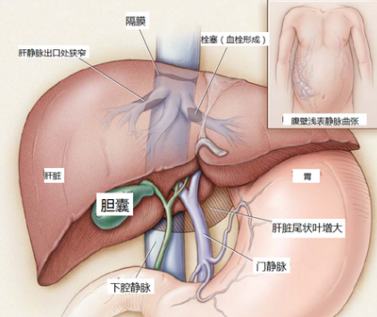 <b>丙型肝炎容易诱发严重的皮肤病</b>