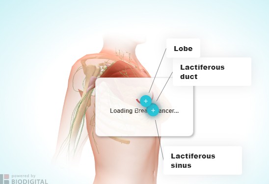 乳腺癌是一种始于乳房的肿瘤。它是女性中最常见的癌症类型药厂实拍