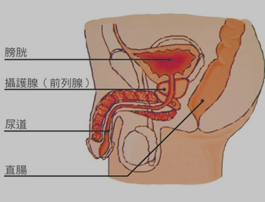 前列腺癌