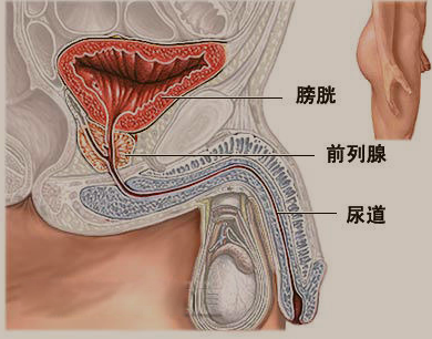 二甲双胍可降低高危前列腺癌患