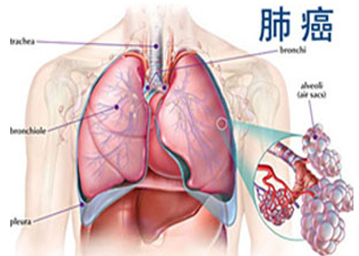 奥希替尼适合治疗哪种类型的癌症药厂实拍