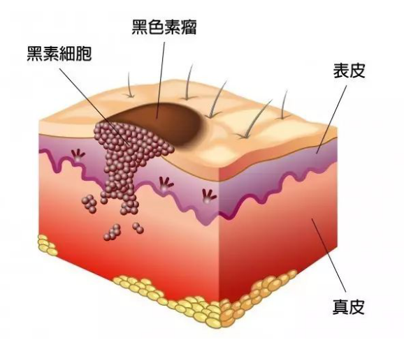 如何,抑制,黑色素,瘤,细胞,生长,来自,研究所,