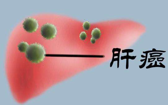 PD-1免疫治疗药物纳武单抗治疗