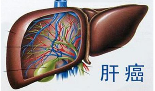 不适合手术的晚期肝癌患者可以选择纳武单抗药厂实拍