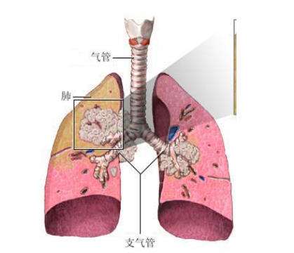 <b>特罗凯和易瑞沙有什么区别？</b>药厂实拍