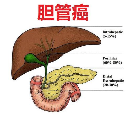 <b>胆管癌有哪些靶向药可以治疗？</b>药厂实拍