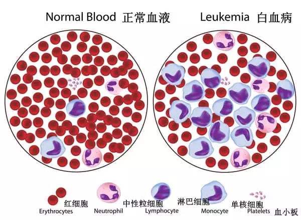 免疫疗法药物可改善某些白血病复发儿童的预后药厂实拍