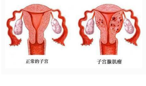 <b>FDA批准Oriahnn于六月底在美上市</b>