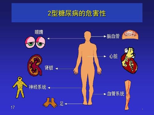 2型糖尿病的症状是什么