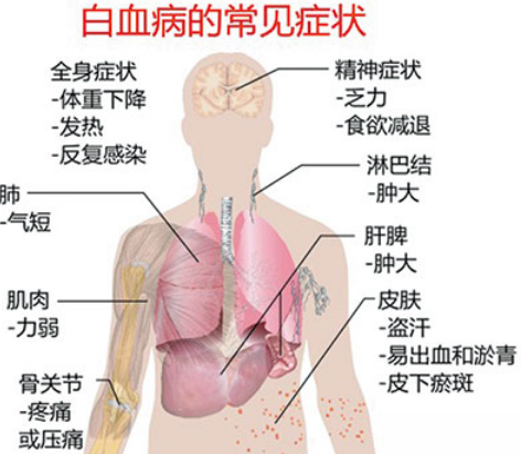 服用维奈托克的副作用有哪些？