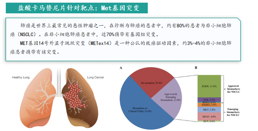 卡马替尼