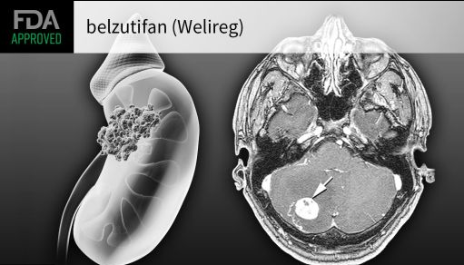 肾细胞癌新药Welireg (belzutifan)