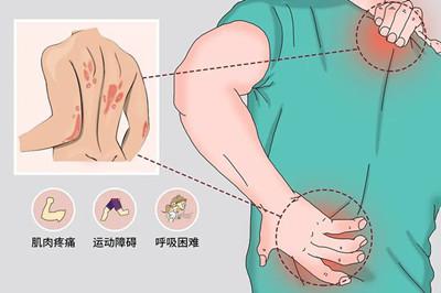 <b>11款治疗皮肌炎(DM)的药物</b>药厂实拍