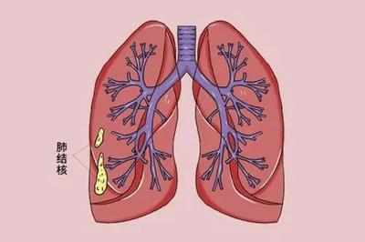 <b>治疗结核病的4种抗生素药物</b>药厂实拍