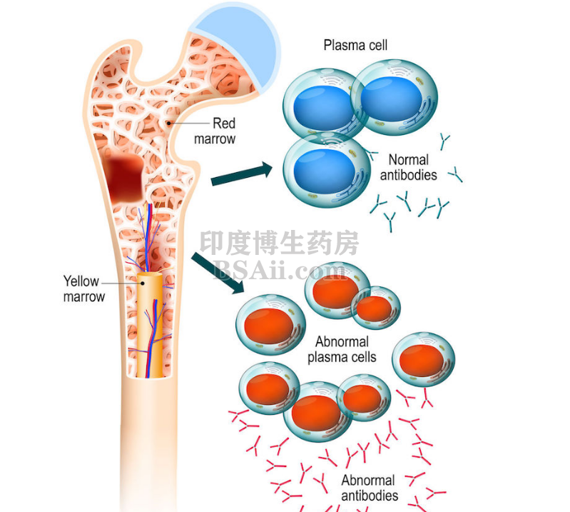 骨髓瘤是恶性肿瘤吗？早期有什么症状？药厂实拍