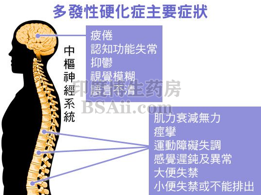 系统性硬化症(SSc)