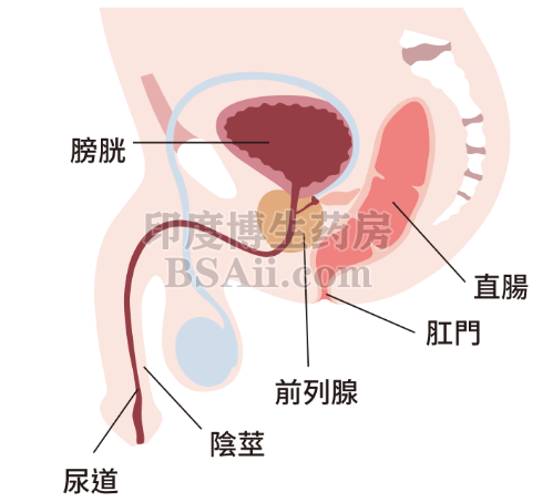 前列腺癌的发病原因有哪些？药厂实拍