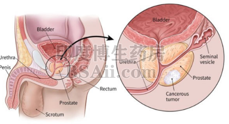 治疗前列腺癌的药物有哪些？药厂实拍