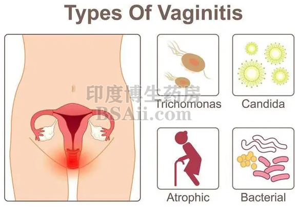 宫颈癌需要切除子宫的吗？药厂实拍