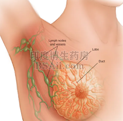 哪些人群是乳腺癌的高危人群？药厂实拍