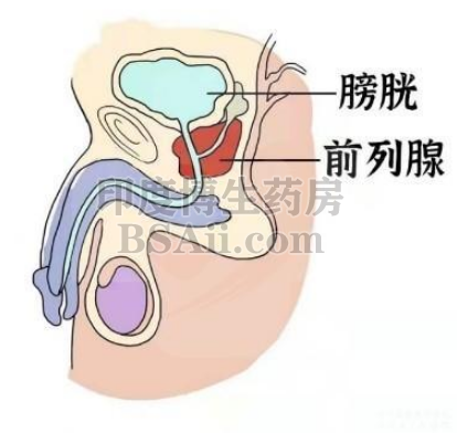 前列腺癌患者的生存期是多少？药厂实拍