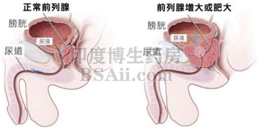 在与医生进行前列腺检查期间会