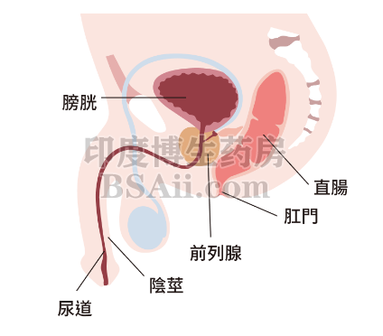 什么是前列腺检查？