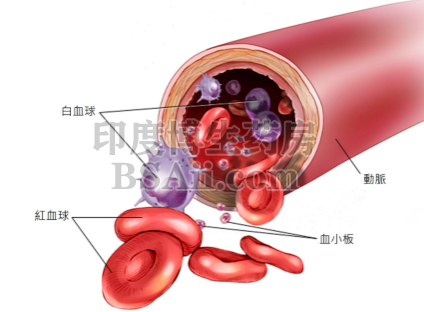 急性淋巴细胞白血病概述 常见的儿童癌症药厂实拍