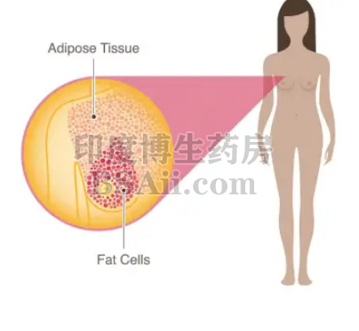 得了乳腺癌动一动活得更久药厂实拍