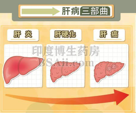 世界肝癌发病率排名第一的国家药厂实拍