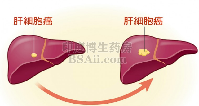 一染上肝癌 身上必出现4类症状药厂实拍