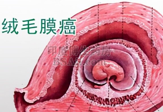 <b>4款治疗绒毛膜癌的化疗药</b>药厂实拍