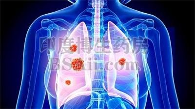 3类治疗肺类癌的化疗