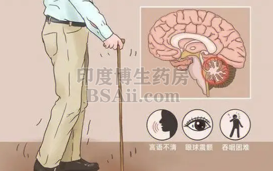 多系统萎缩