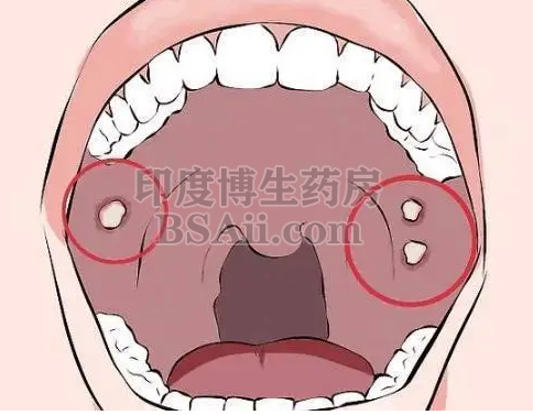 <b>12种主要治疗口腔癌/口咽癌的药物</b>药厂实拍