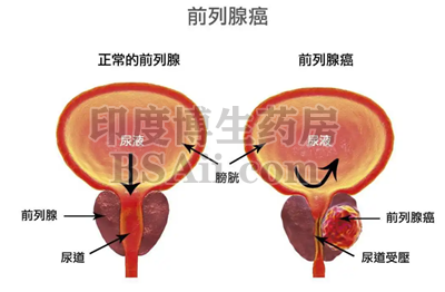 <b>5种治疗前列腺癌的靶向药/免疫</b>