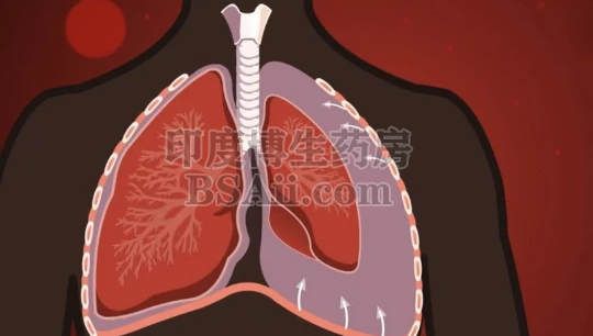 <b>2款治疗恶性胸腔积液(MPE)的药物</b>药厂实拍