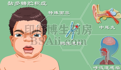 <b>5款治疗黏多糖贮积症(MPS)的药物</b>药厂实拍