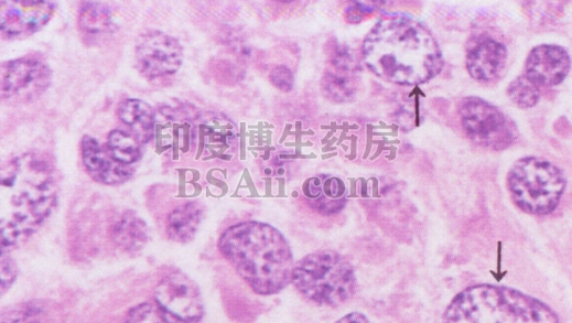 <b>10款治疗弥漫性大B细胞淋巴瘤(DLBCL)的靶向/免疫药物</b>药厂实拍