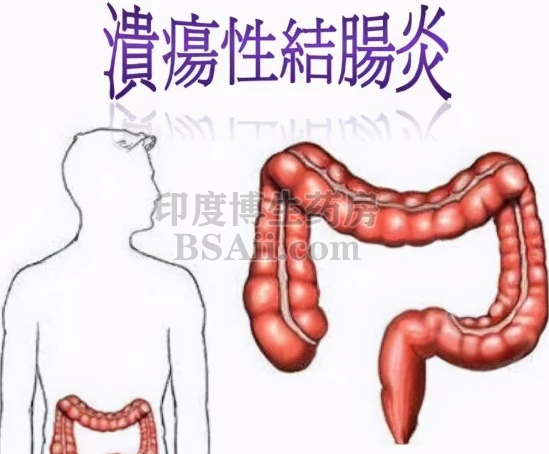 16种治疗溃疡性结肠炎(UC)的靶向药/免疫/生物制剂